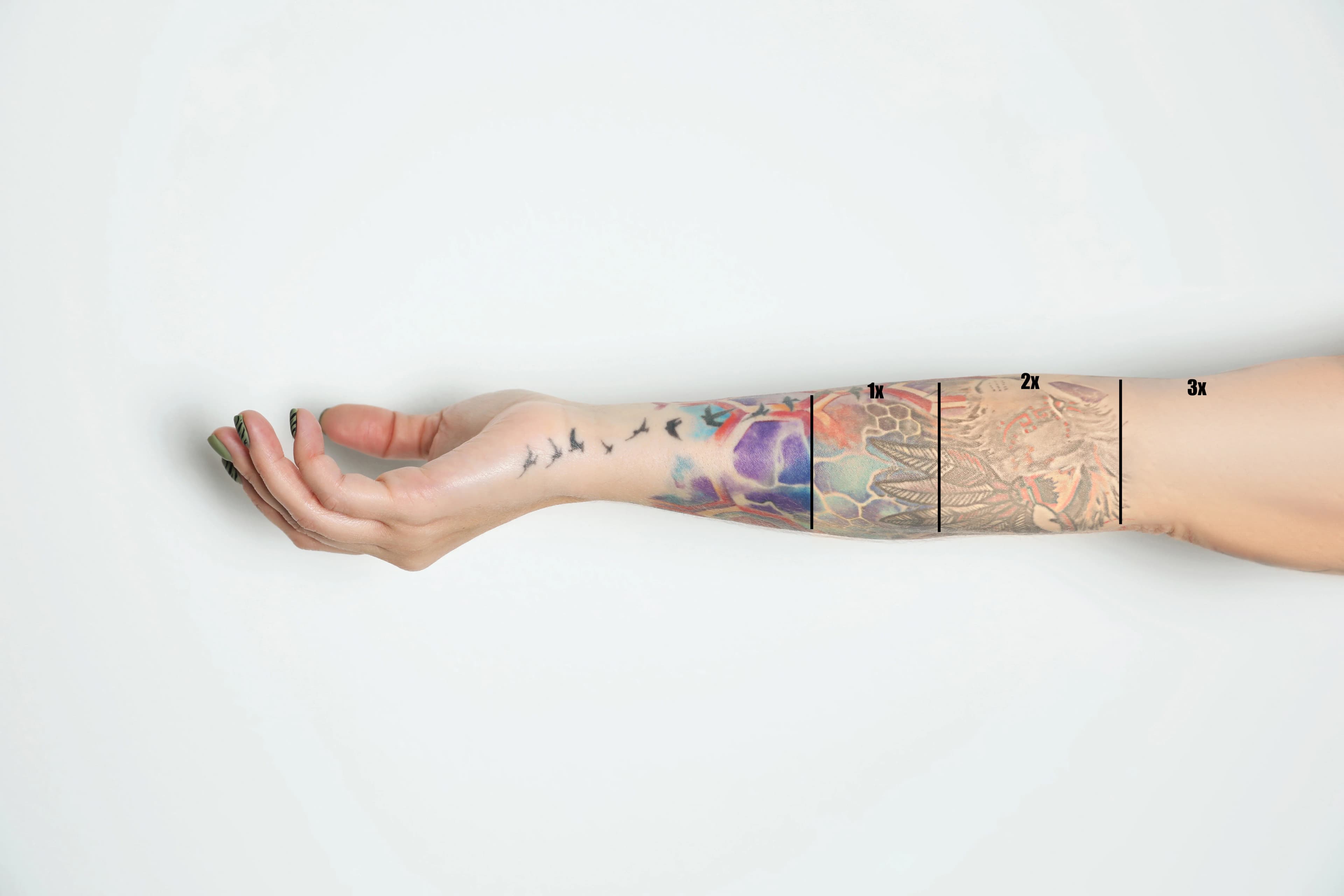 Laser Tattoo Removal