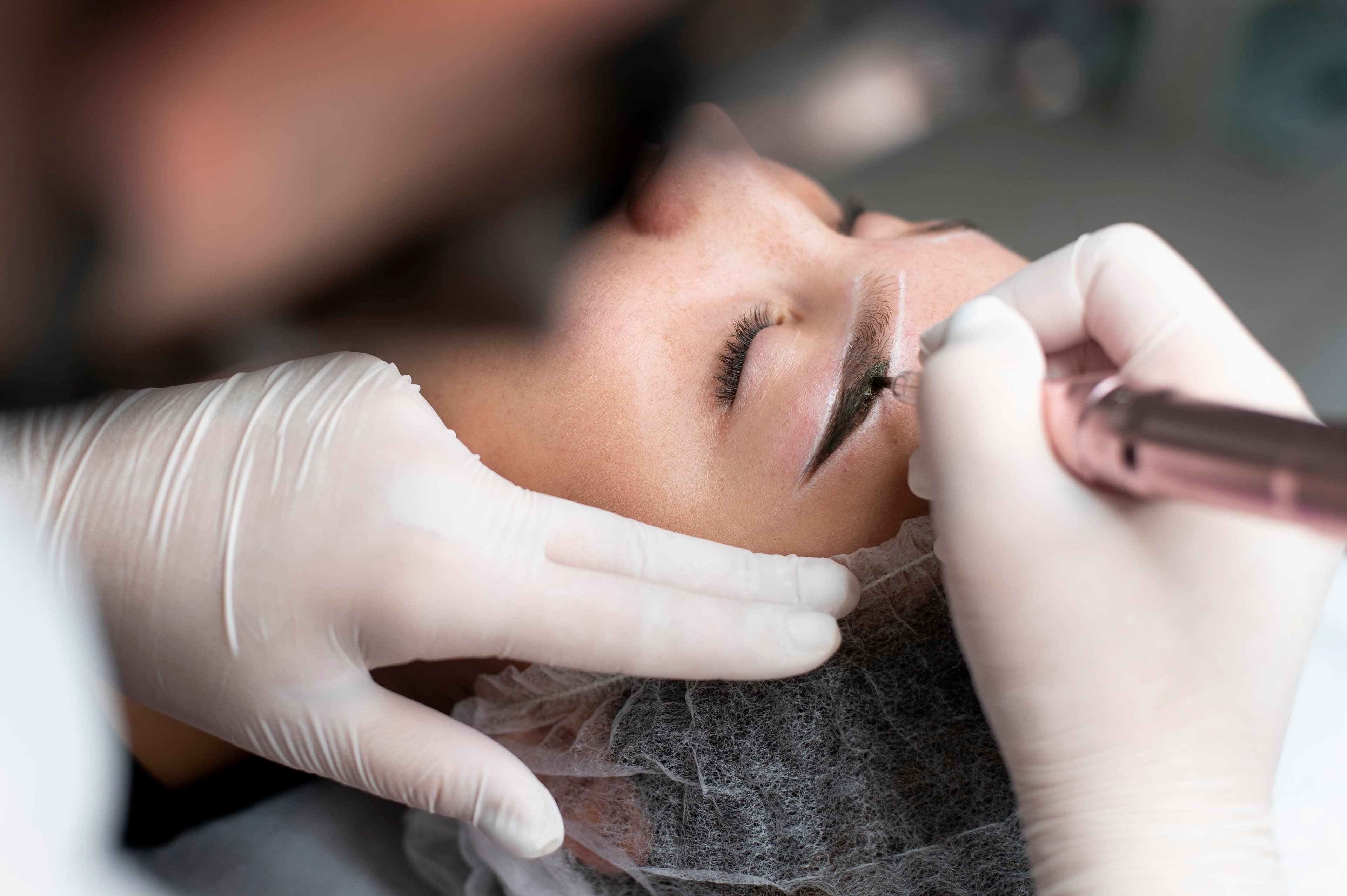 Non-Laser Tattoo Removal